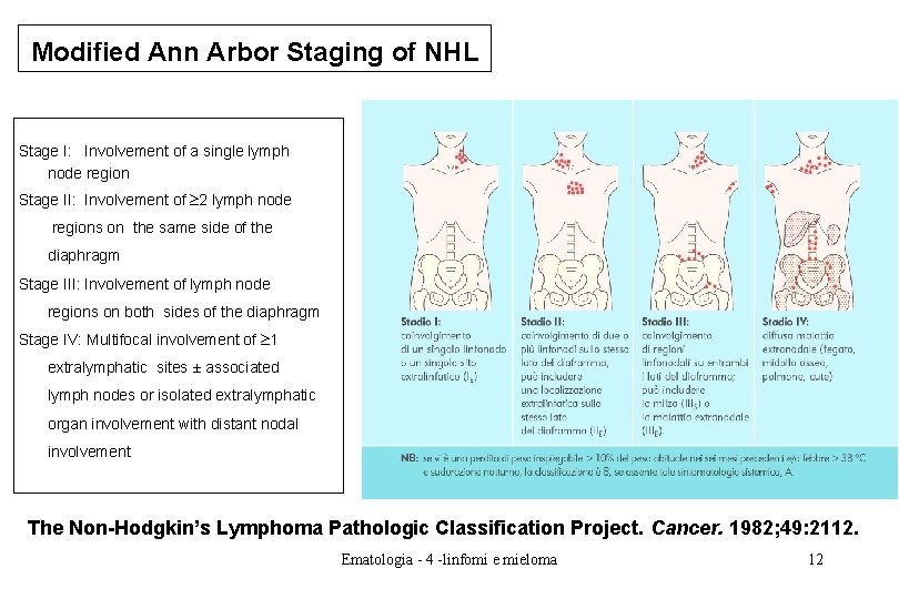 Modified Ann Arbor Staging of NHL Stage I: Involvement of a single lymph node Modified Ann Arbor Staging of NHL Stage I: Involvement of a single lymph node