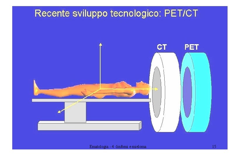 Ematologia - 4 -linfomi e mieloma 15 Ematologia - 4 -linfomi e mieloma 15