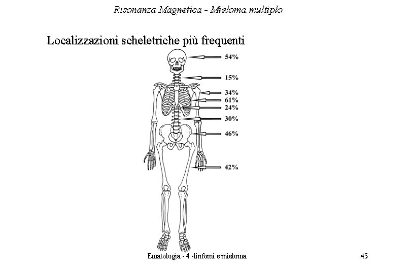 Risonanza Magnetica - Mieloma multiplo Localizzazioni scheletriche più frequenti Ematologia - 4 -linfomi e Risonanza Magnetica - Mieloma multiplo Localizzazioni scheletriche più frequenti Ematologia - 4 -linfomi e