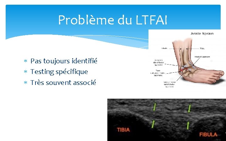 Problème du LTFAI Pas toujours identifié Testing spécifique Très souvent associé 