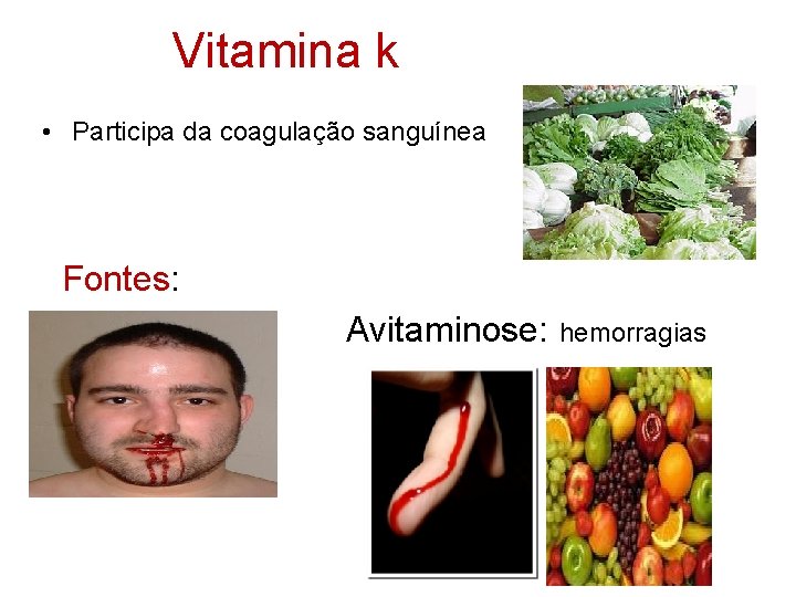 Vitamina k • Participa da coagulação sanguínea Fontes: Avitaminose: hemorragias 