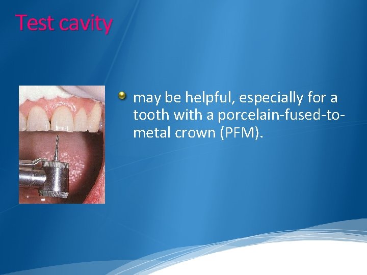 Test cavity may be helpful, especially for a tooth with a porcelain-fused-tometal crown (PFM).