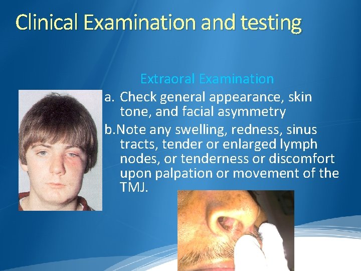 Clinical Examination and testing Extraoral Examination a. Check general appearance, skin tone, and facial