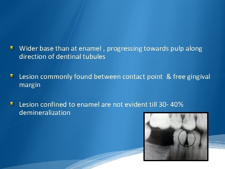 Wider base than at enamel , progressing towards pulp along direction of dentinal tubules