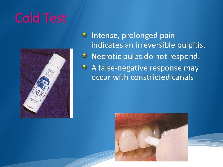 Cold Test Intense, prolonged pain indicates an irreversible pulpitis. Necrotic pulps do not respond.