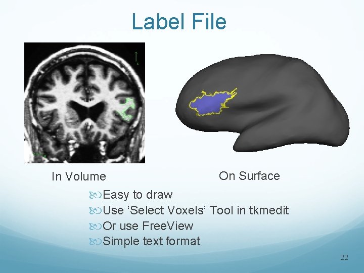 Label File On Surface In Volume Easy to draw Use ‘Select Voxels’ Tool in