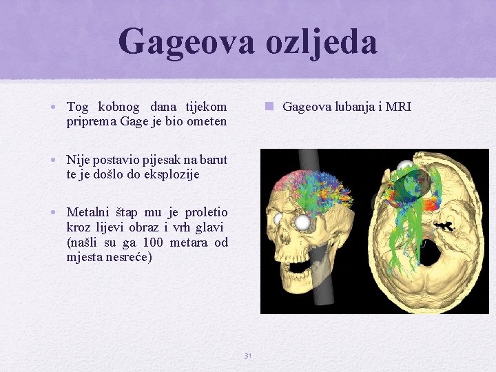 Gageova ozljeda • Tog kobnog dana tijekom priprema Gage je bio ometen n Gageova