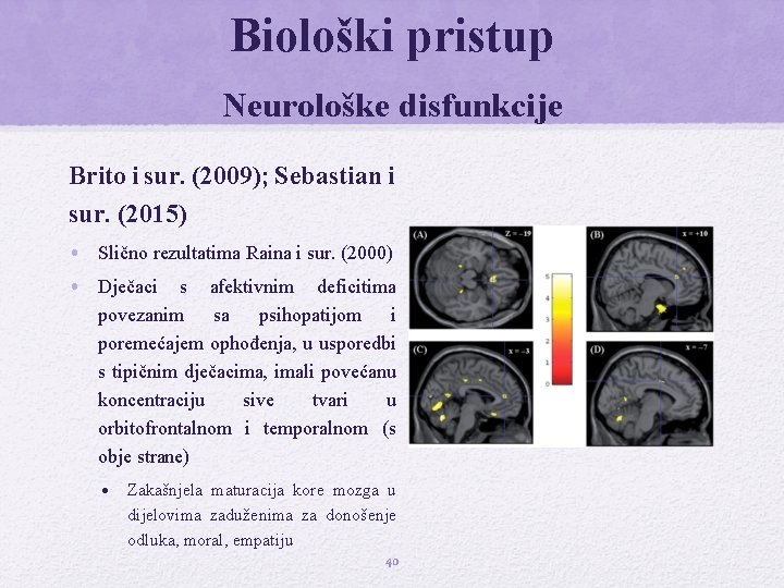 Biološki pristup Neurološke disfunkcije Brito i sur. (2009); Sebastian i sur. (2015) • Slično