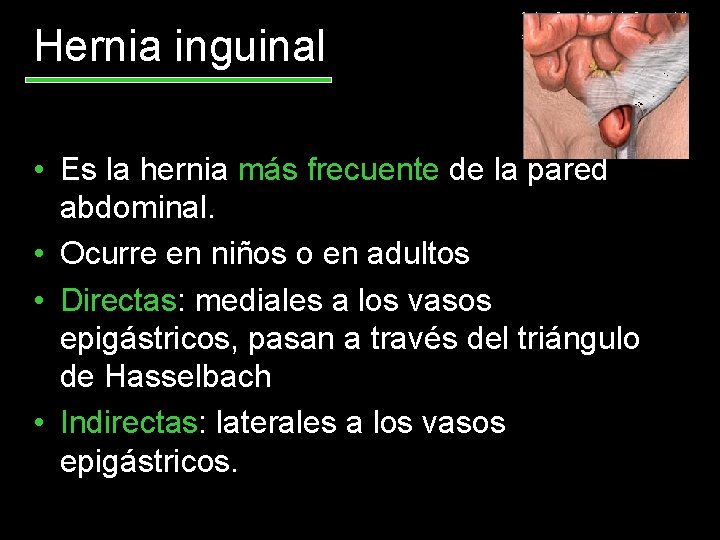 Hernia inguinal • Es la hernia más frecuente de la pared abdominal. • Ocurre