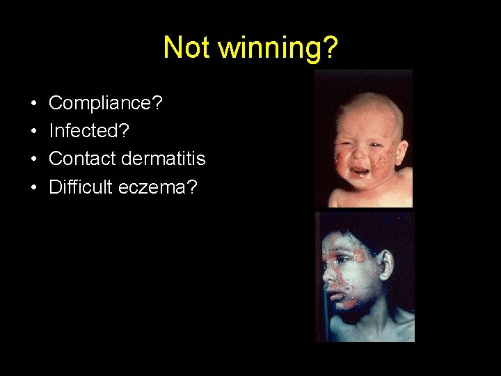 Not winning? • • Compliance? Infected? Contact dermatitis Difficult eczema? 