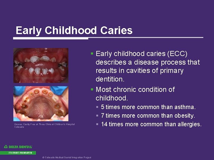 Early Childhood Caries § Early childhood caries (ECC) describes a disease process that results