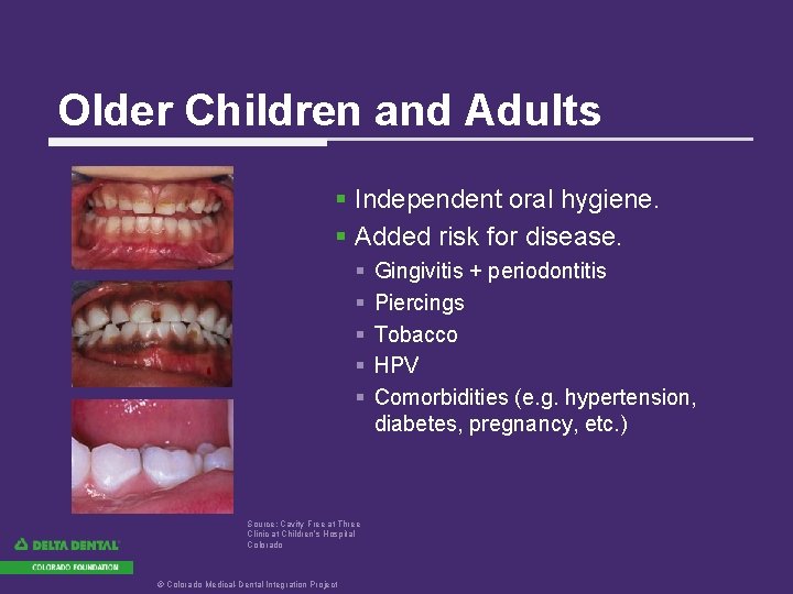 Older Children and Adults § Independent oral hygiene. § Added risk for disease. §