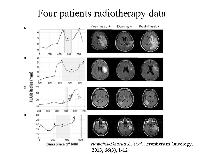 Four patients radiotherapy data Hawkins-Daarud A. et. al. , Frontiers in Oncology, 2013, 66(3), Four patients radiotherapy data Hawkins-Daarud A. et. al. , Frontiers in Oncology, 2013, 66(3),
