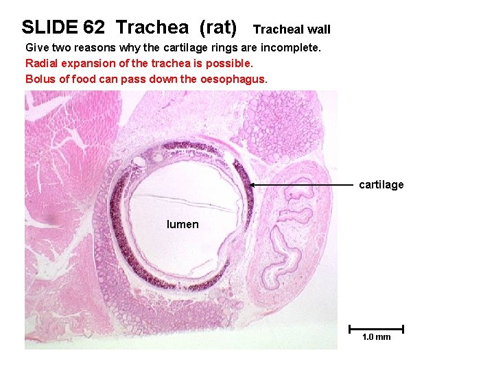 SLIDE 62 Trachea (rat) Tracheal wall Give two reasons why the cartilage rings are
