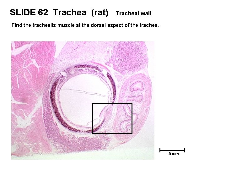 SLIDE 62 Trachea (rat) Tracheal wall Find the trachealis muscle at the dorsal aspect