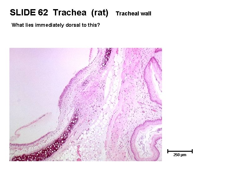 SLIDE 62 Trachea (rat) Tracheal wall What lies immediately dorsal to this? 250 µm