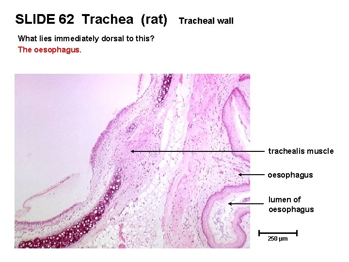 SLIDE 62 Trachea (rat) Tracheal wall What lies immediately dorsal to this? The oesophagus.