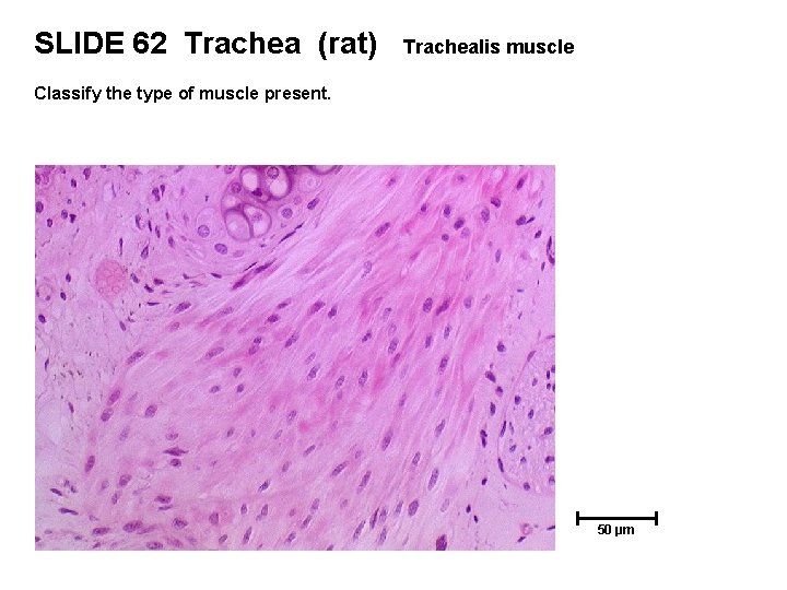 SLIDE 62 Trachea (rat) Trachealis muscle Classify the type of muscle present. 50 µm