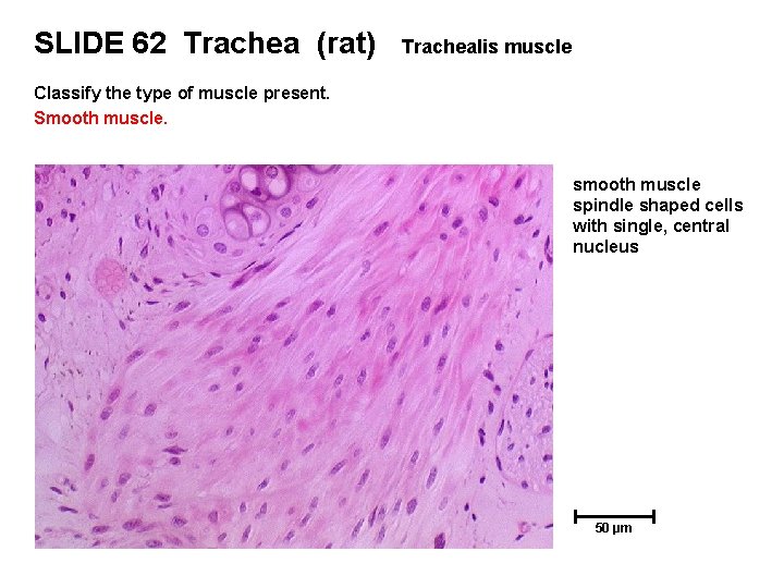 SLIDE 62 Trachea (rat) Trachealis muscle Classify the type of muscle present. Smooth muscle.