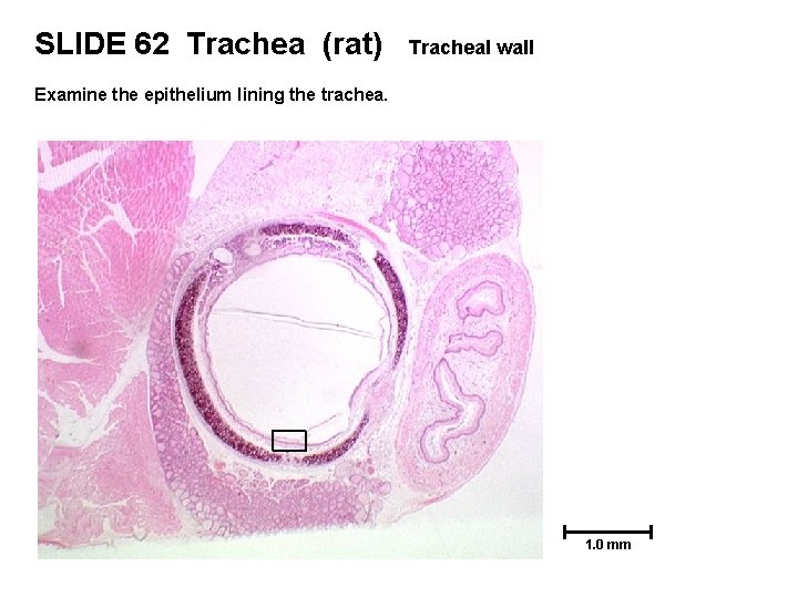 SLIDE 62 Trachea (rat) Tracheal wall Examine the epithelium lining the trachea. 1. 0