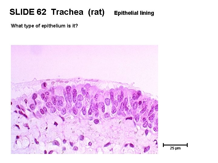 SLIDE 62 Trachea (rat) Epithelial lining What type of epithelium is it? 25 µm