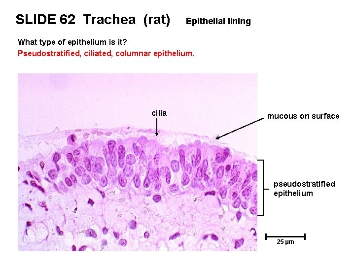 SLIDE 62 Trachea (rat) Epithelial lining What type of epithelium is it? Pseudostratified, ciliated,