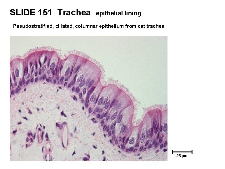 SLIDE 151 Trachea epithelial lining Pseudostratified, ciliated, columnar epithelium from cat trachea. 25 µm
