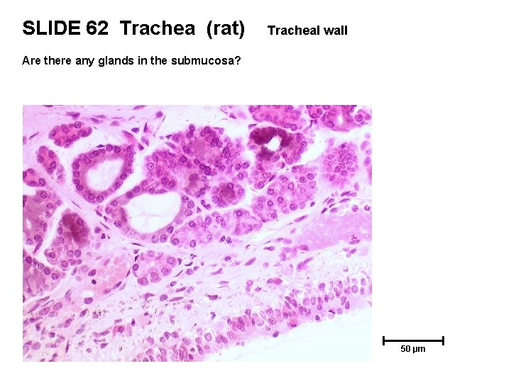 SLIDE 62 Trachea (rat) Tracheal wall Are there any glands in the submucosa? 50