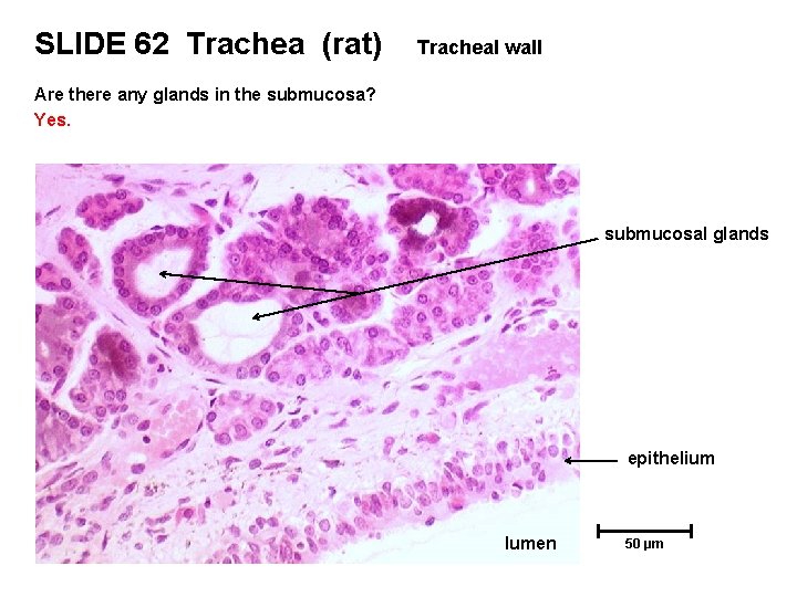 SLIDE 62 Trachea (rat) Tracheal wall Are there any glands in the submucosa? Yes.
