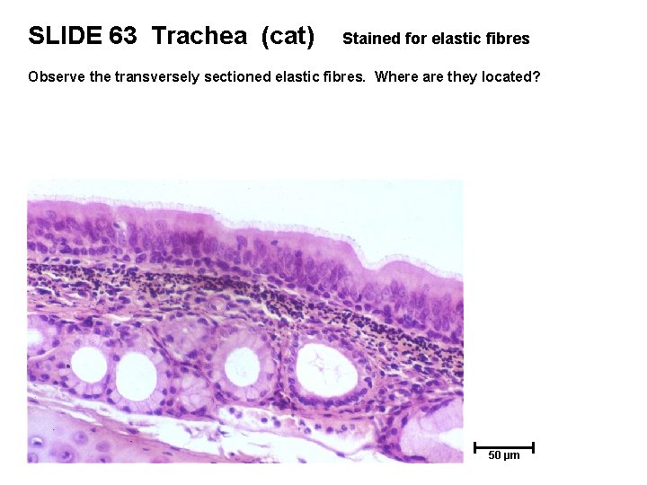 SLIDE 63 Trachea (cat) Stained for elastic fibres Observe the transversely sectioned elastic fibres.