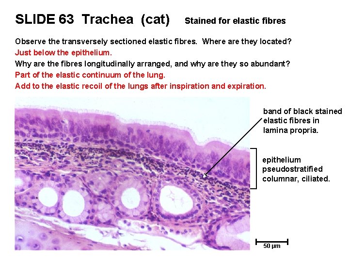 SLIDE 63 Trachea (cat) Stained for elastic fibres Observe the transversely sectioned elastic fibres.