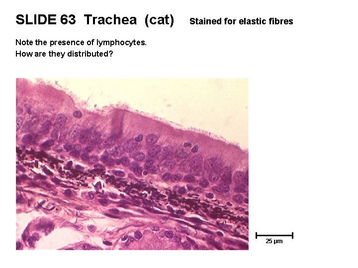 SLIDE 63 Trachea (cat) Stained for elastic fibres Note the presence of lymphocytes. How