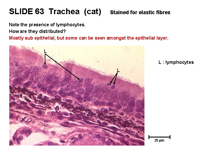 SLIDE 63 Trachea (cat) Stained for elastic fibres Note the presence of lymphocytes. How