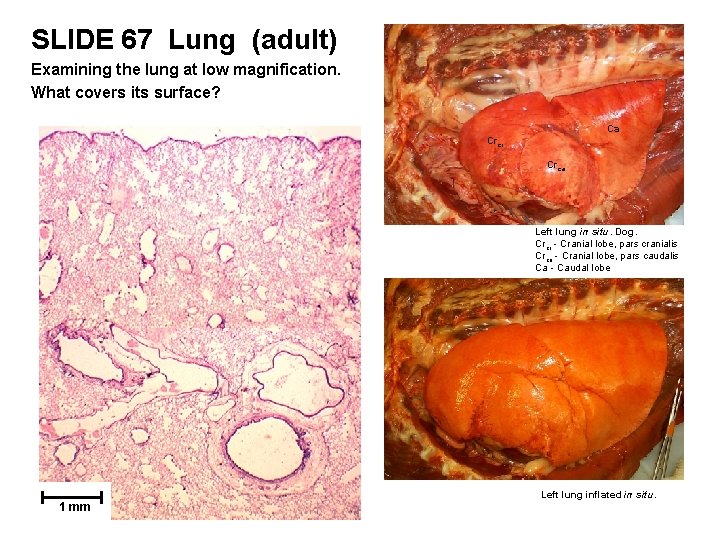 SLIDE 67 Lung (adult) Examining the lung at low magnification. What covers its surface?