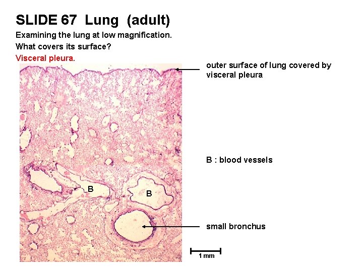 SLIDE 67 Lung (adult) Examining the lung at low magnification. What covers its surface?