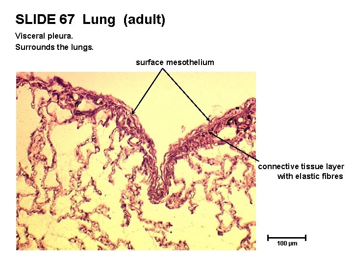 SLIDE 67 Lung (adult) Visceral pleura. Surrounds the lungs. surface mesothelium connective tissue layer