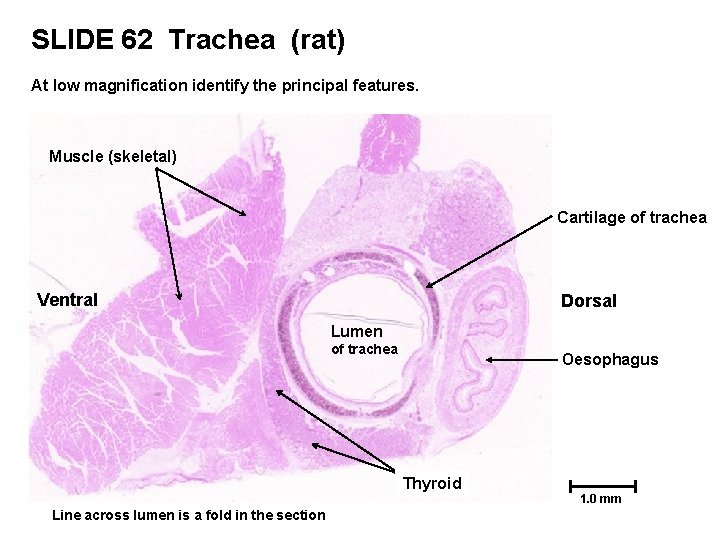 SLIDE 62 Trachea (rat) At low magnification identify the principal features. Muscle (skeletal) Cartilage