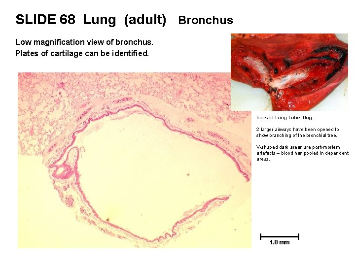 SLIDE 68 Lung (adult) Bronchus Low magnification view of bronchus. Plates of cartilage can