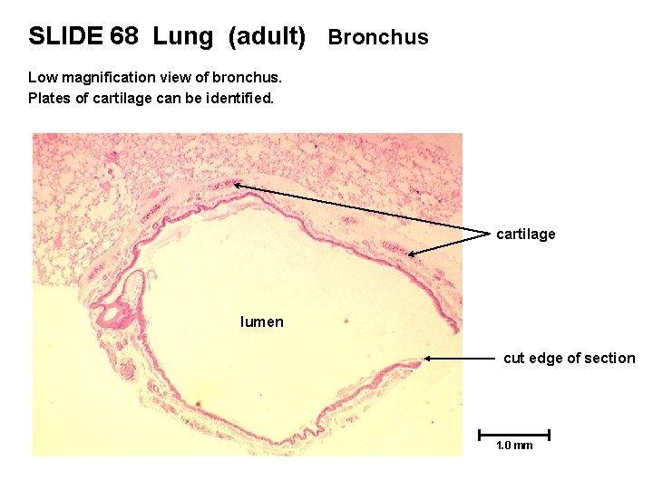 SLIDE 68 Lung (adult) Bronchus Low magnification view of bronchus. Plates of cartilage can