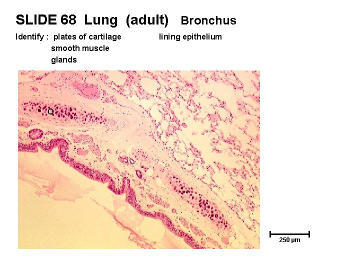 SLIDE 68 Lung (adult) Bronchus Identify : plates of cartilage smooth muscle glands lining