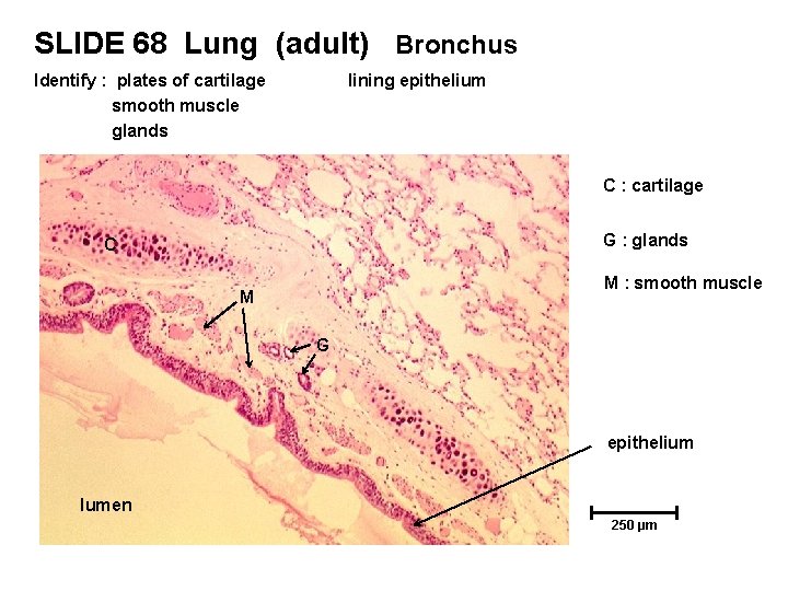 SLIDE 68 Lung (adult) Bronchus Identify : plates of cartilage smooth muscle glands lining