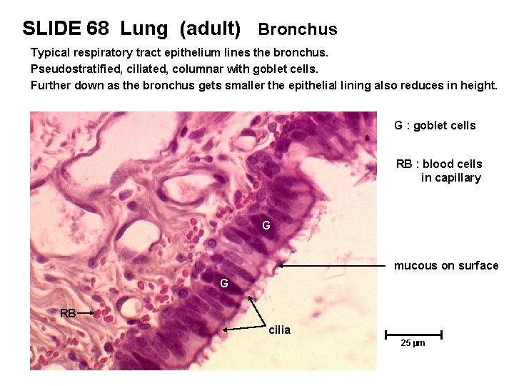 SLIDE 68 Lung (adult) Bronchus Typical respiratory tract epithelium lines the bronchus. Pseudostratified, ciliated,