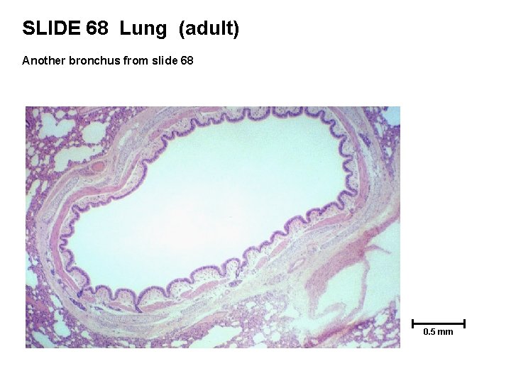 SLIDE 68 Lung (adult) Another bronchus from slide 68 0. 5 mm 