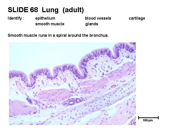 SLIDE 68 Lung (adult) Identify : epithelium smooth muscle blood vessels glands cartilage Smooth