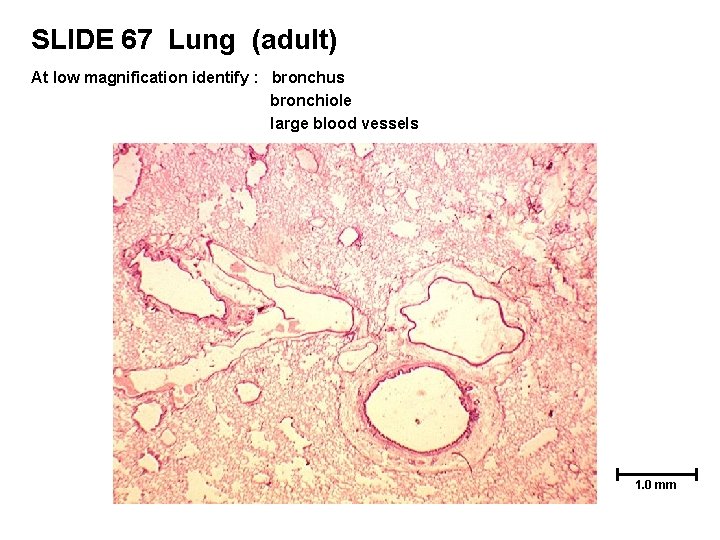 SLIDE 67 Lung (adult) At low magnification identify : bronchus bronchiole large blood vessels