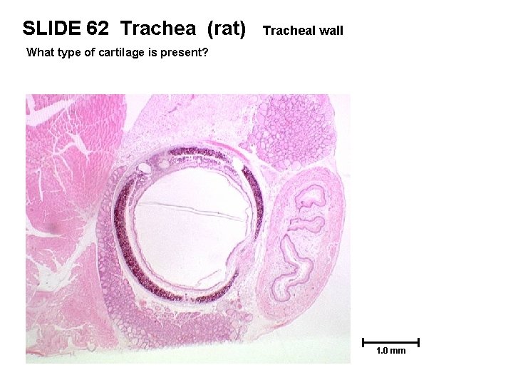 SLIDE 62 Trachea (rat) Tracheal wall What type of cartilage is present? 1. 0