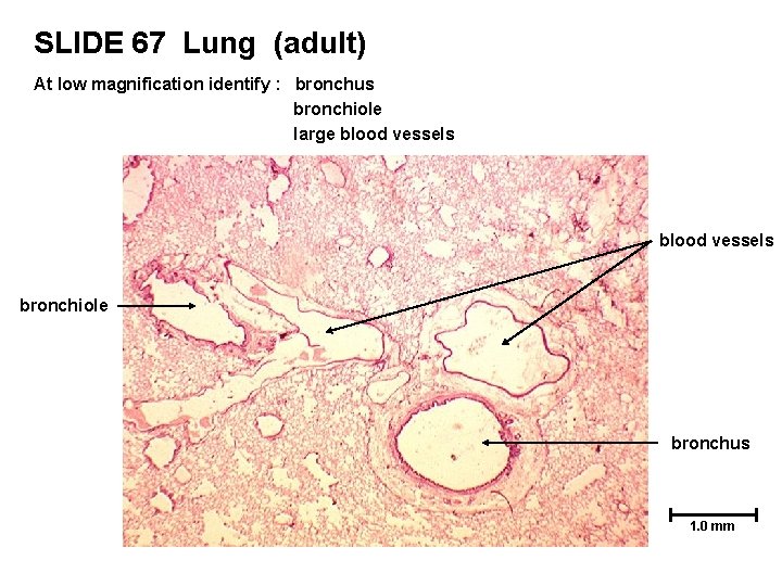 SLIDE 67 Lung (adult) At low magnification identify : bronchus bronchiole large blood vessels