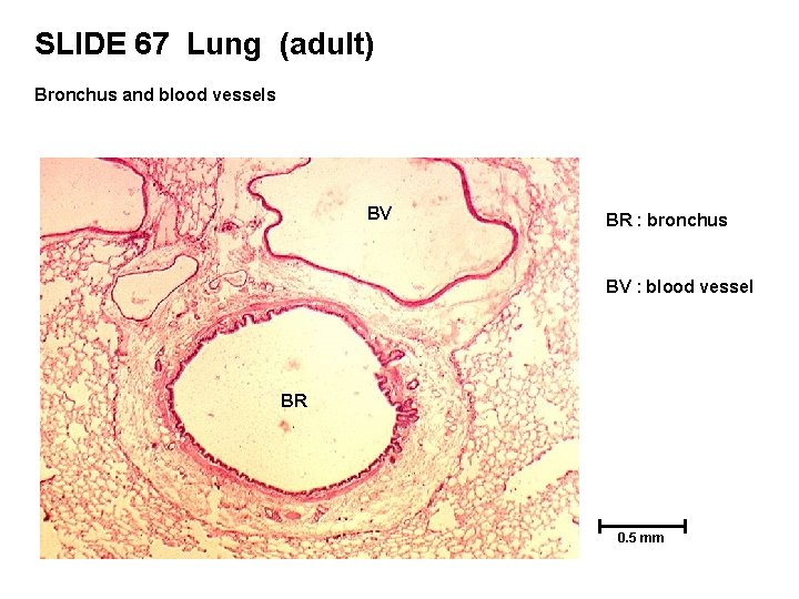 SLIDE 67 Lung (adult) Bronchus and blood vessels BV BR : bronchus BV :