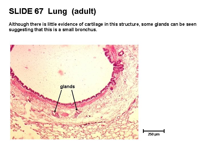 SLIDE 67 Lung (adult) Although there is little evidence of cartilage in this structure,