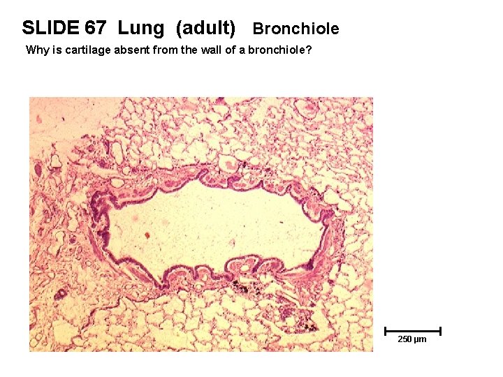 SLIDE 67 Lung (adult) Bronchiole Why is cartilage absent from the wall of a